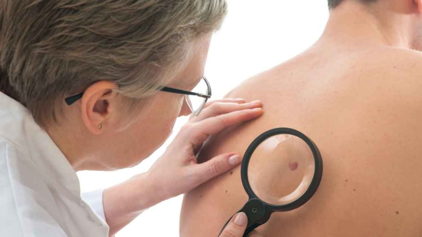 Winter is the best time for a skin check, here's why - HSMC